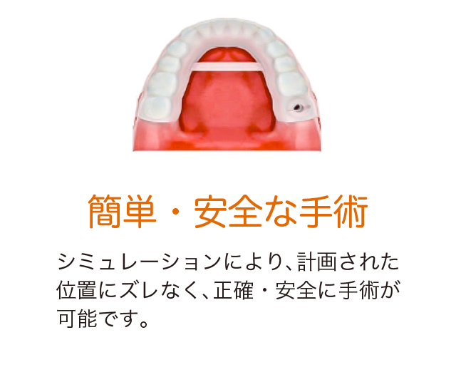 簡単・安全な手術