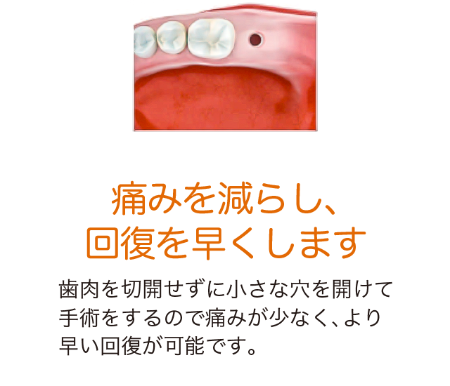 痛みを減らし、回復を早くします